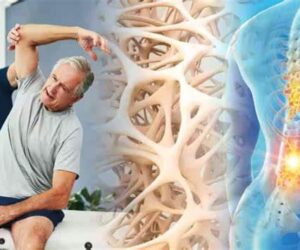 Osteoporosis